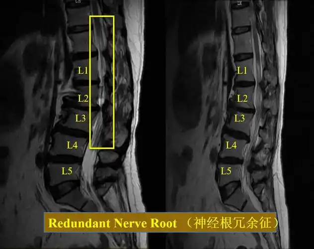 超能刀客止麻先锋故事会│009号腰痛的故事