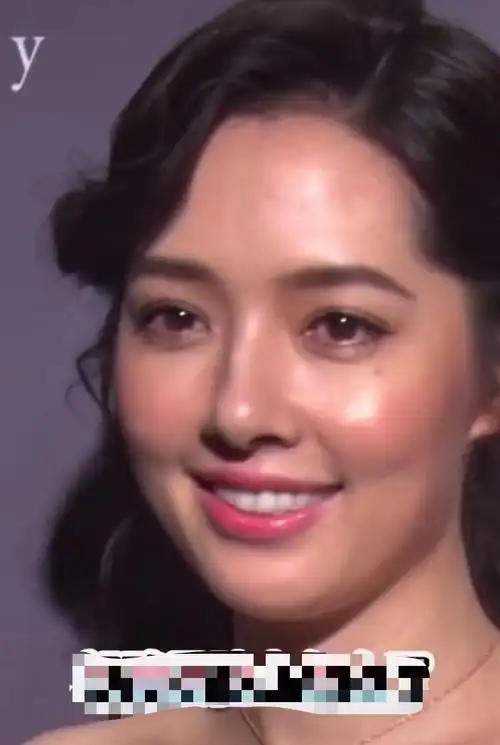 郭碧婷嫁向佐越来越丑生图脸僵下巴歪苹果肌肿满脸油腻全是坑