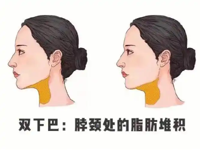 如何塑造下颌缘轮廓线