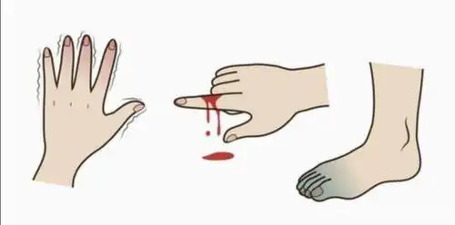 是意外多?还是违规多?