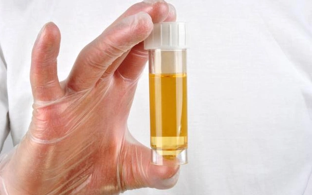 人体的尿液为什么是黄色的?