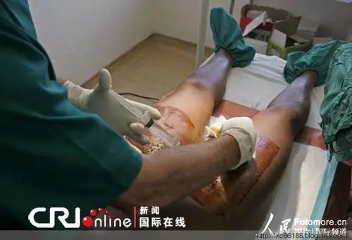 世界各地男子割礼仪式(组图