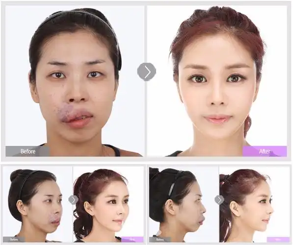 只有"惊人"这样的字眼才能形容吧姐的心情,这不仅仅是丑女的整容经历