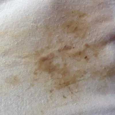 刚刚感觉内裤流了东西,一看是这种,以前从没有这种颜色的白带啊,这什