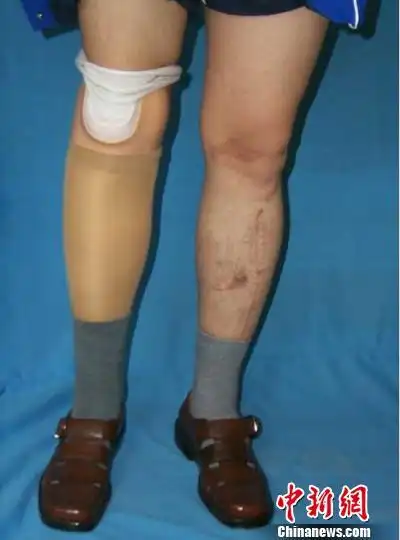 以工匠精神造假他们让截肢者的人生更完整