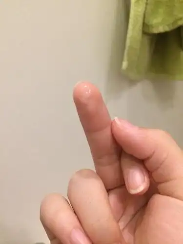 我还在青春期16岁,平时就月经不准.