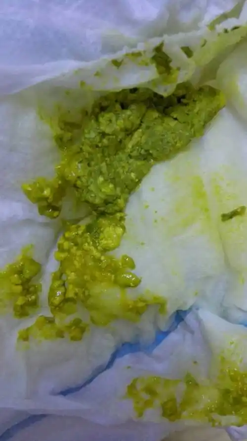 2014-05-20 奚智博 助理医师 三个多月的婴儿