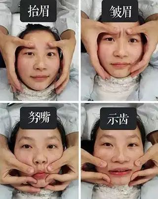 只要在急性水肿期做到位的,在这个时间里,不管你是哪种类型的面瘫,都