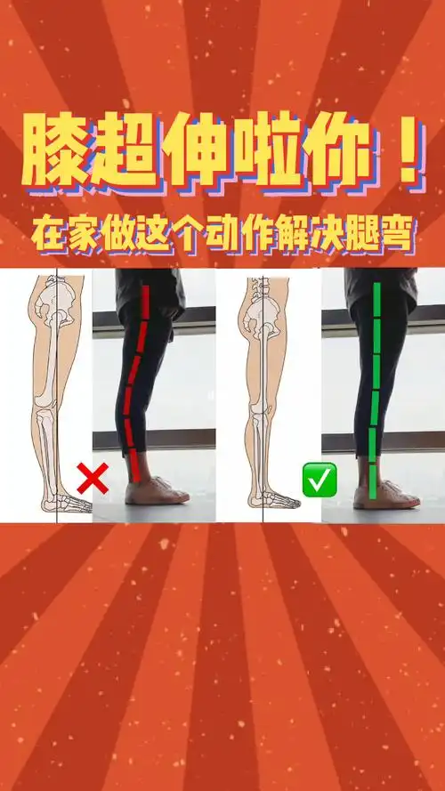 腿弯显矮的膝超伸