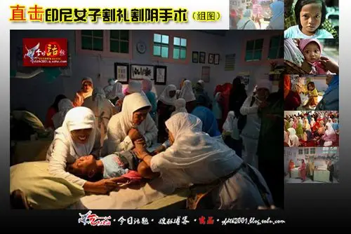 女性割礼主要流行于非洲,西起塞内加尔,东抵埃塞俄比亚海岸,北达埃及