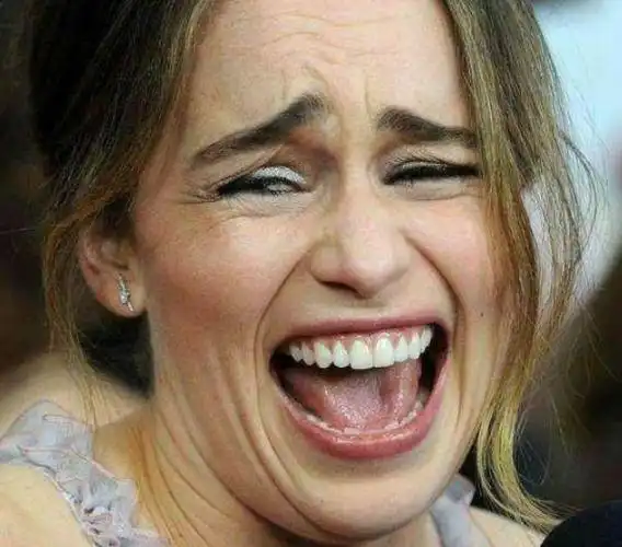 牙龈泪痕一秒幻灭,龙妈囧眉成表情包!