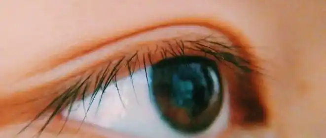 正常情况下,眼白健康的表现主要有光泽度好,颜色瓷白,没有血丝和斑点