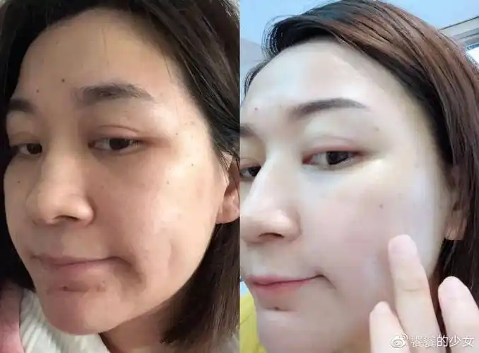 美白祛斑护肤品排行榜祛斑最好的产品是哪一款