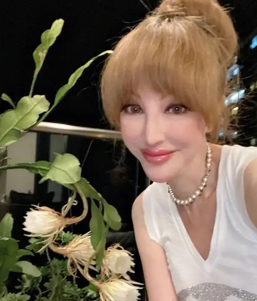 名媛薛芷伦遭遇车祸脖子动弹不得太可怜肇事司机逃之夭夭