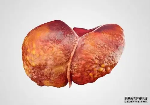 检查出酒精肝应及时控制