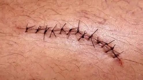 手绘伤口缝线,简直能以假乱真了!