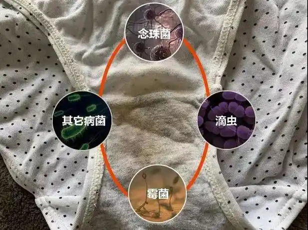 内裤上残留的尿液,私处分泌物,汗臭,混在一起发酵后携带霉菌,白色念珠