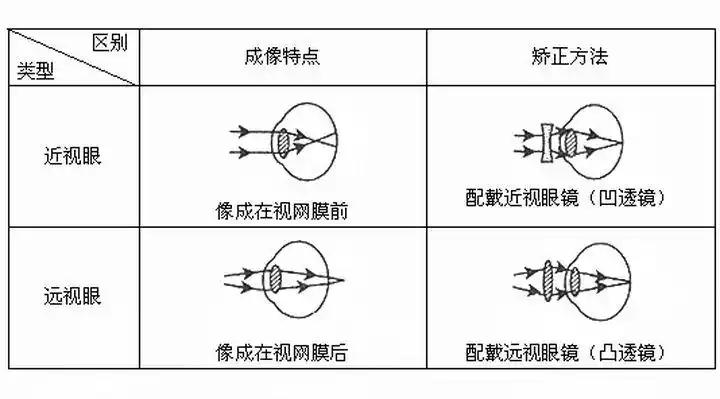 近视眼会老花吗