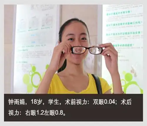 兰州普瑞:超高度近视该如何治疗?