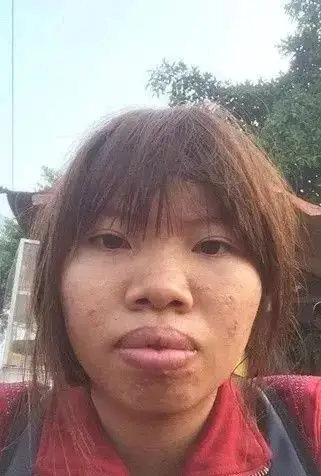 ▼她就是被人嫌弃的丑女quách最近刷屏的越南整形女就有这样的人生▼