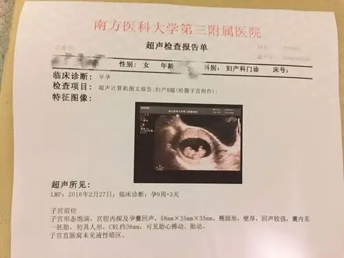 孕9周刚出的b超图,求分析是男宝还是女宝 谢谢