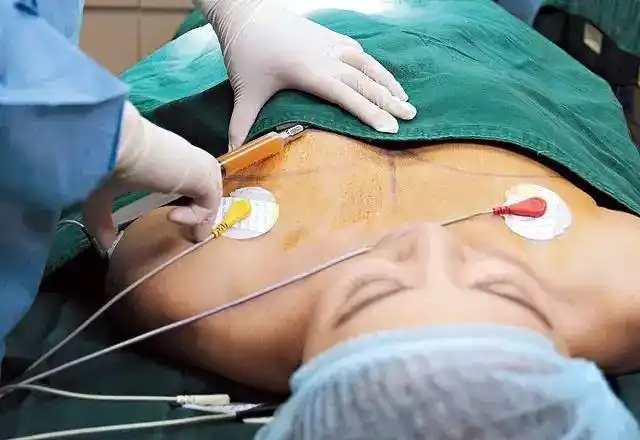 她120小时全程直播整形,震惊娱乐圈!