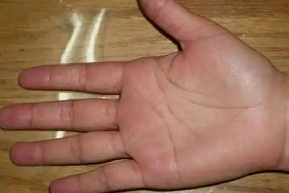 早死的手相是什么生命线的长短深浅是关键迷信