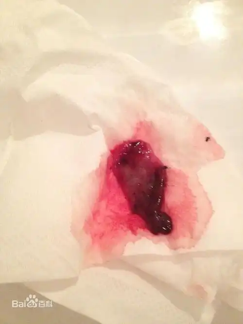 孕囊什么样图片