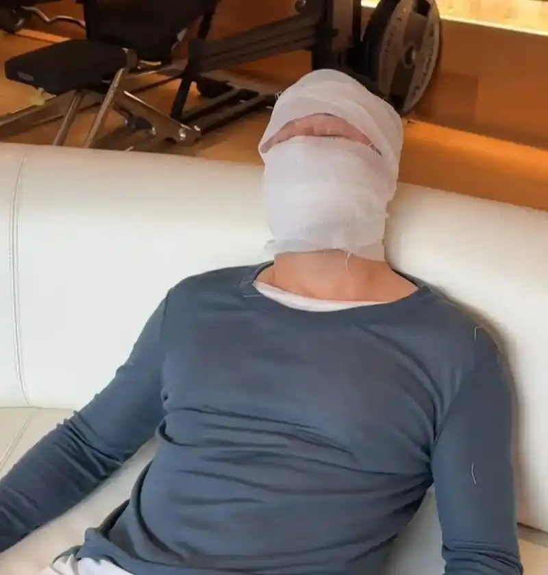 "只见杨坤解开绷带,说自己只是晒了一会儿太阳,怕被晒黑了.