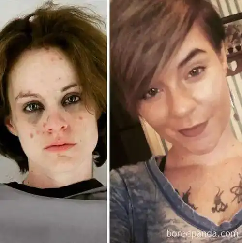 少女被诱惑吸毒,吸嗨后,她抠出了自己的眼珠子