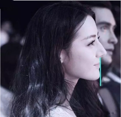 如何改善?最全明星案例告诉你该如何变美-凌姿-爱问医生