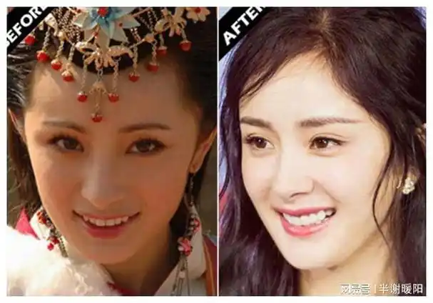 当年的杨幂,有着一口烟雾缭绕下洁白如玉的牙齿,与脸型极为协调.