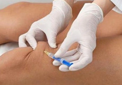 滑膜炎偏方麦麸子加醋赶走恼人的滑膜炎