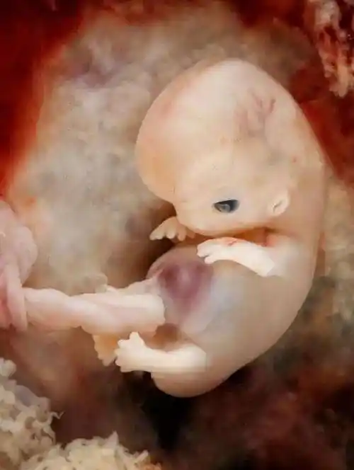 从怀孕到分娩, 宝宝在肚子里的胎儿照, 第一次看到这儿清晰的图!