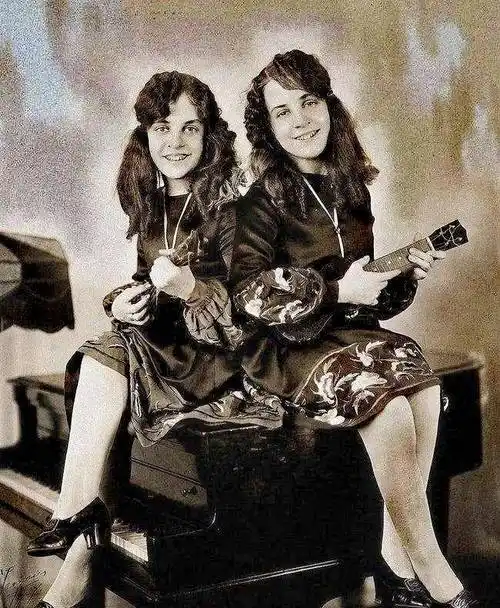 英国连体姐妹:被人当成赚钱工具,姐姐死后,妹妹与遗体共存2天-我的