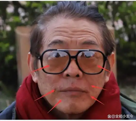 口水能过敏,天生没子宫,这8位明星的"隐疾",困扰他们