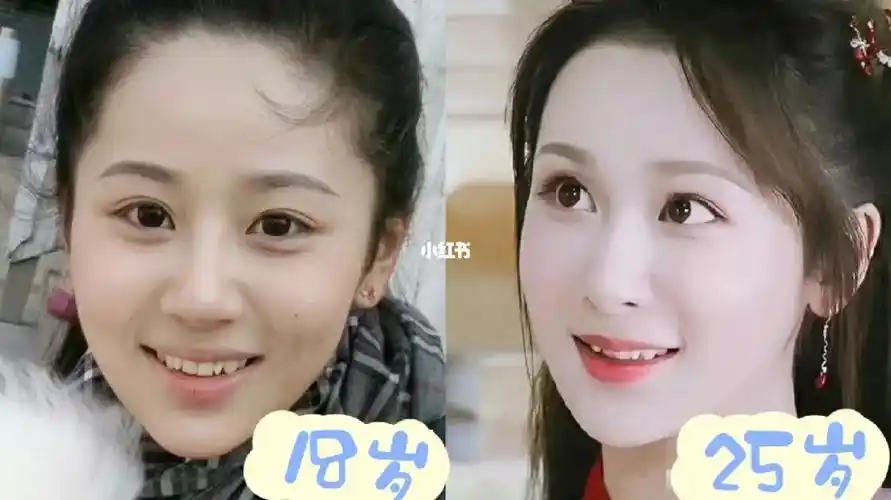 小虎牙时期的杨紫真的很可爱呀