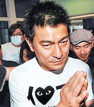 刘德华早前因为压力大,憔悴秃顶