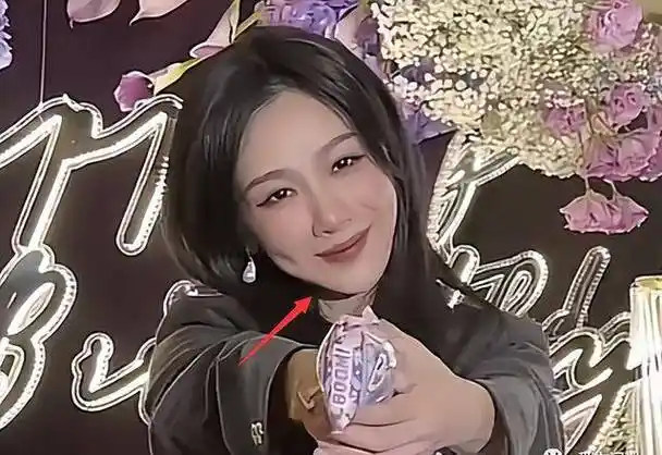 杨紫被质疑整容,晒庆生照模样大变,满脸通红,脸肿僵硬不自然_祝福