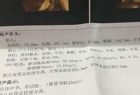 b超单上这3个"数据",和胎儿的出生时间的有关,早知道早受益_时候_数值