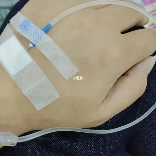 因为话太多而挂吊针