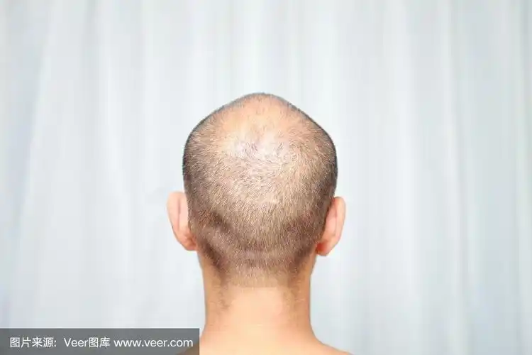 后脑勺,剃光头,中老年男人,男人,图像