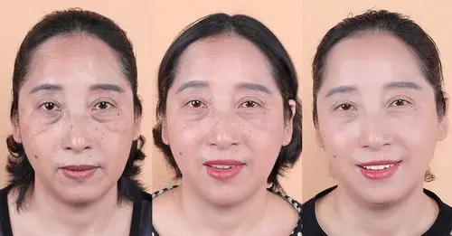 眼部的年轻状态,说一说眼部抗衰的重要性_女物美容网|nvwu.com