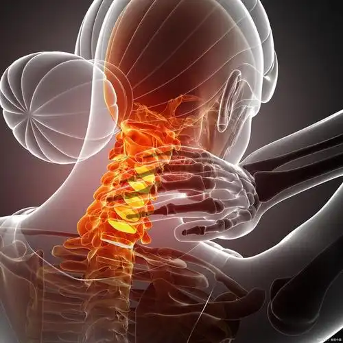 如何诊断颈椎病?