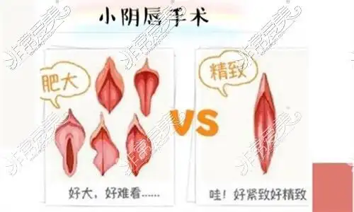 南宁哪个整形医院有私密?内阴道紧致 外阴漂红价格优惠!