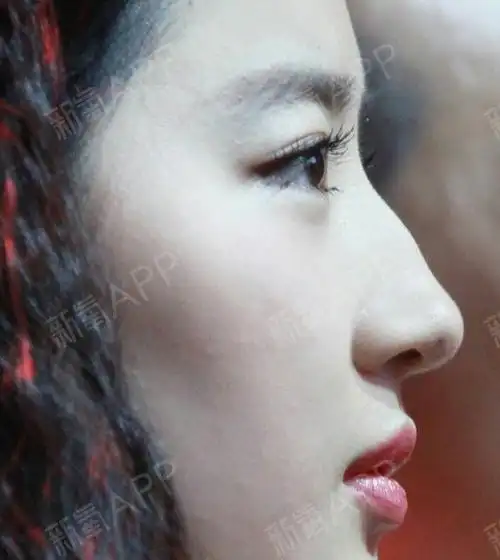 驼峰鼻颜值bug还是美的特色