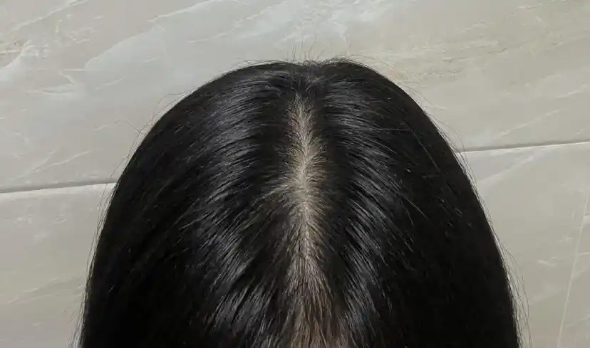 怎样让头发变得浓密