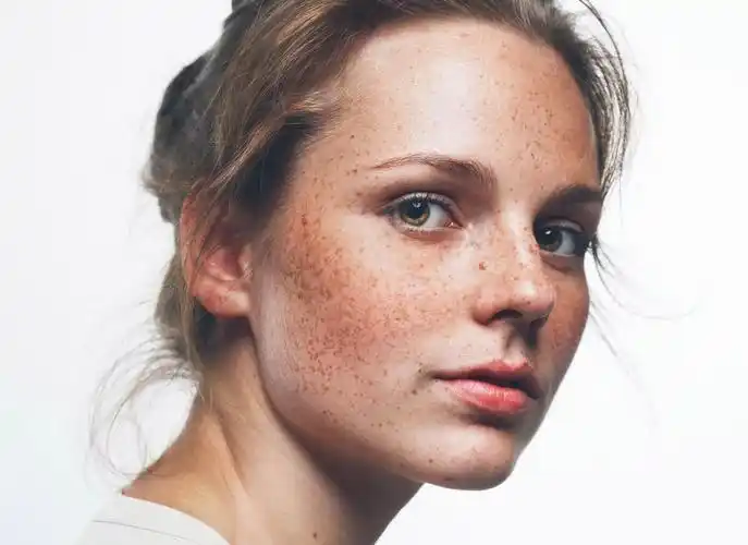 雀斑脸素材-雀斑脸图片-雀斑脸素材图片下载-觅知网
