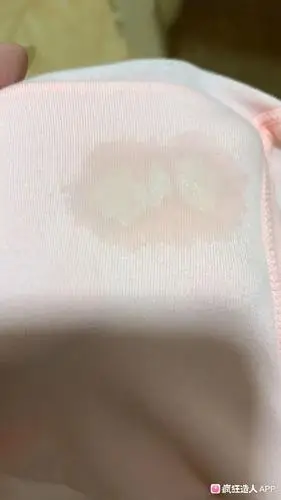 孕中期白色分泌物