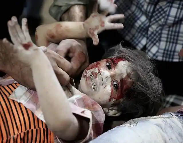 野战医院,在空袭中死去的儿童尸体.